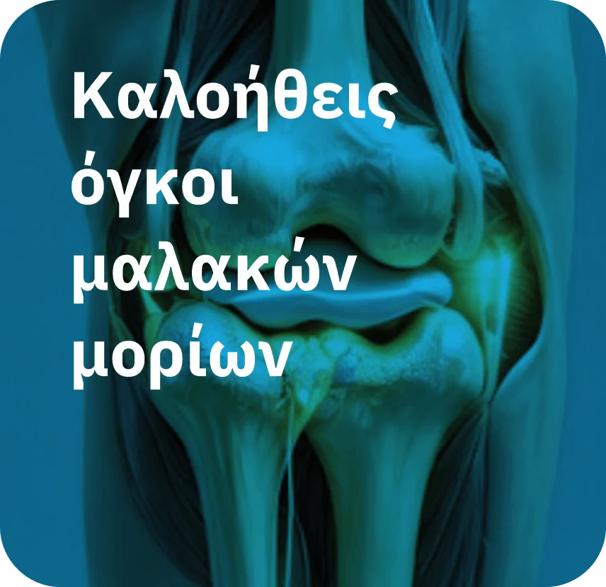 Καλοήθεις όγκοι μαλακών μορίων