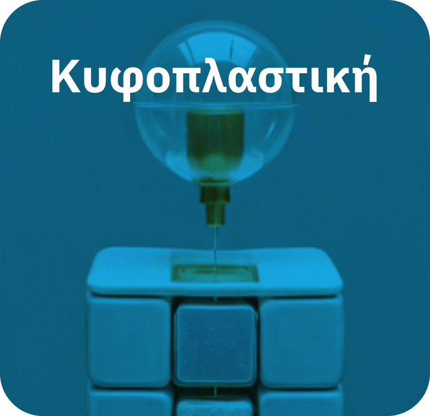 Κυφοπλαστική