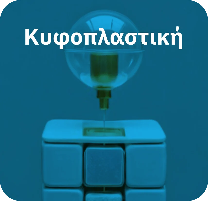Κυφοπλαστική