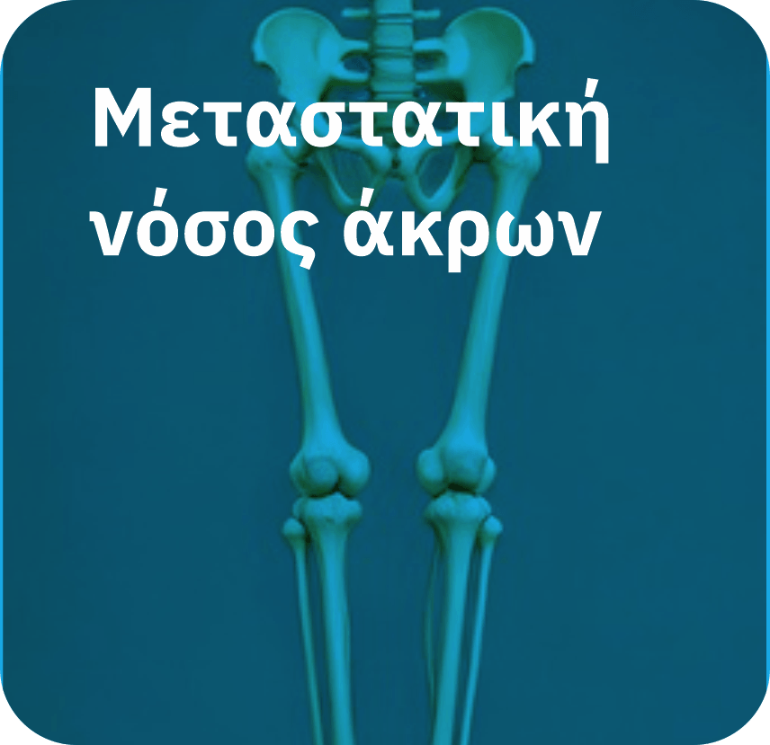Μεταστατική νόσος άκρων