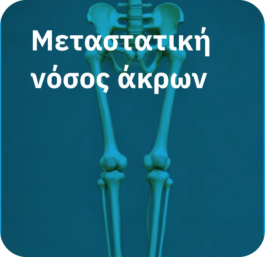 Μεταστατική νόσος άκρων