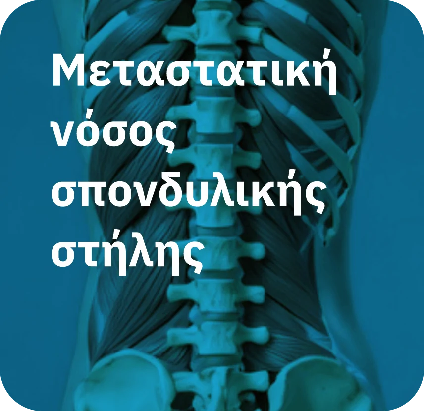 Μεταστατική νόσος σπονδυλικής στήλης