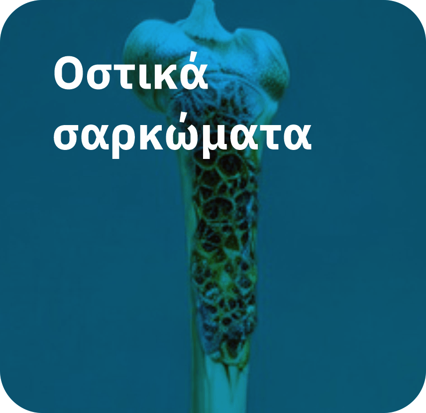 Οστικά σαρκώματα