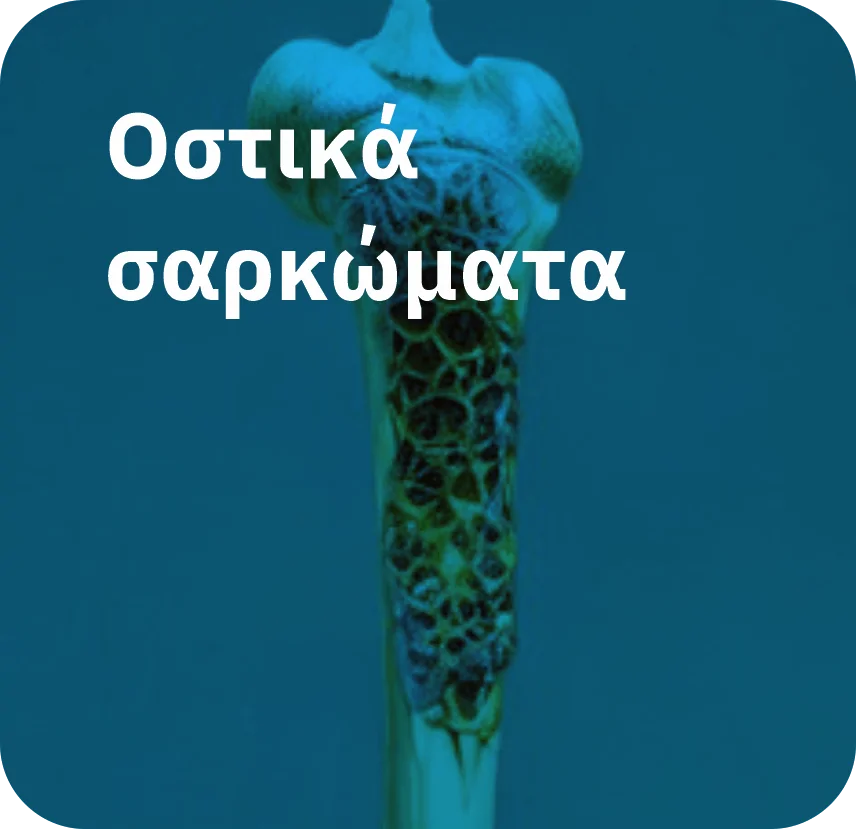 Οστικά σαρκώματα